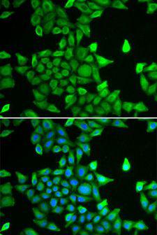 PSMA6 Antibody - Immunofluorescence analysis of MCF-7 cells using PSMA6 antibody. Blue: DAPI for nuclear staining.
