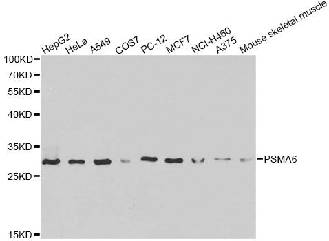 PSMA6 Antibody - Western blot analysis of extracts of various cell lines, using PSMA6 antibody at 1:1000 dilution. The secondary antibody used was an HRP Goat Anti-Rabbit IgG (H+L) at 1:10000 dilution. Lysates were loaded 25ug per lane and 3% nonfat dry milk in TBST was used for blocking.