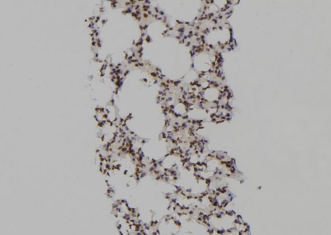 PSMA6 Antibody - 1:100 staining mouse lung tissue by IHC-P. The sample was formaldehyde fixed and a heat mediated antigen retrieval step in citrate buffer was performed. The sample was then blocked and incubated with the antibody for 1.5 hours at 22°C. An HRP conjugated goat anti-rabbit antibody was used as the secondary.