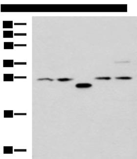 PSMA6 Antibody - Western blot analysis of 293T cell lysates  using PSMA6 Polyclonal Antibody at dilution of 1:1000