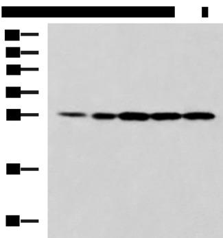 PSMA6 Antibody - Western blot analysis of 293T Jurkat and A375 cell lysates  using PSMA6 Polyclonal Antibody at dilution of 1:900