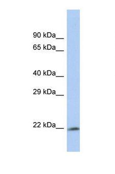 PSMA6 Antibody - Western blot of Human HepG2. PSMA6 antibody dilution 1.0 ug/ml.  This image was taken for the unconjugated form of this product. Other forms have not been tested.
