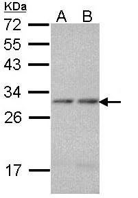 PSMA7 Antibody - Sample (30 ug of whole cell lysate). A: A431 , B: H1299. 12% SDS PAGE. HSPC / PSMA7 antibody diluted at 1:1000.