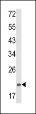 PSMA7 Antibody - Western blot of PSMA7 Antibody in mouse spleen tissue lysates (35 ug/lane). PSMA7 (arrow) was detected using the purified antibody.