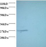 PSMA7 Antibody - Western blot of Proteasome subunit alpha type-7 antibody at 2 ug/ml. Lane 1:293T whole cell lysate. Lane 2: EC109whole cell lysate. Secondary: Goat polyclonal to Rabbit IgG at 1:15000 dilution. Predicted band size: 27 kDa. Observed band size: 27 kDa.  This image was taken for the unconjugated form of this product. Other forms have not been tested.