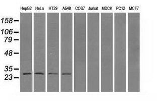 PSMA7 Antibody - Western blot analysis of extracts (35ug) from 9 different cell lines by using anti-PSMA7 monoclonal antibody.