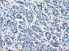PSMA7 Antibody - Immunohistochemical staining of paraffin-embedded breast tissue using anti-PSMA7 mouse monoclonal antibody. (Dilution 1:50).