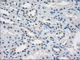 PSMA7 Antibody - Immunohistochemical staining of paraffin-embedded Kidney tissue using anti-PSMA7 mouse monoclonal antibody. (Dilution 1:50).