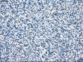 PSMA7 Antibody - Immunohistochemical staining of paraffin-embedded Ovary tissue using anti-PSMA7 mouse monoclonal antibody. (Dilution 1:50).