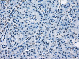 PSMA7 Antibody - Immunohistochemical staining of paraffin-embedded pancreas tissue using anti-PSMA7 mouse monoclonal antibody. (Dilution 1:50).