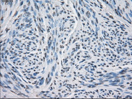 PSMA7 Antibody - Immunohistochemical staining of paraffin-embedded endometrium tissue using anti-PSMA7 mouse monoclonal antibody. (Dilution 1:50).