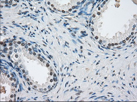 PSMA7 Antibody - Immunohistochemical staining of paraffin-embedded prostate tissue using anti-PSMA7 mouse monoclonal antibody. (Dilution 1:50).