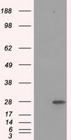 PSMA7 Antibody - HEK293T cells were transfected with the pCMV6-ENTRY control (Left lane) or pCMV6-ENTRY PSMA7 (Right lane) cDNA for 48 hrs and lysed. Equivalent amounts of cell lysates (5 ug per lane) were separated by SDS-PAGE and immunoblotted with anti-PSMA7.