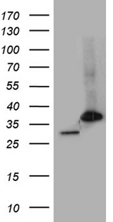 PSMA7 Antibody - HEK293T cells were transfected with the pCMV6-ENTRY control. (Left lane) or pCMV6-ENTRY PSMA7. (Right lane) cDNA for 48 hrs and lysed. Equivalent amounts of cell lysates. (5 ug per lane) were separated by SDS-PAGE and immunoblotted with anti-PSMA7. (1:2000)