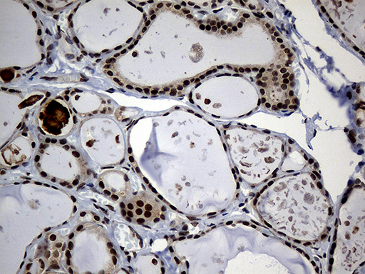 PSMA7 Antibody - Immunohistochemical staining of paraffin-embedded Human thyroid tissue within the normal limits using anti-PSMA7 mouse monoclonal antibody. (Heat-induced epitope retrieval by 1mM EDTA in 10mM Tris buffer. (pH8.5) at 120°C for 3 min. (1:2000)