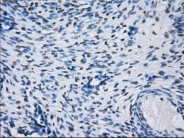 PSMA7 Antibody - IHC of paraffin-embedded Ovary tissue using anti-PSMA7 mouse monoclonal antibody. (Dilution 1:50).