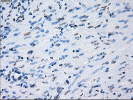 PSMA7 Antibody - IHC of paraffin-embedded prostate tissue using anti-PSMA7 mouse monoclonal antibody. (Dilution 1:50).