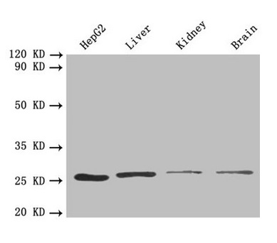 PSMA7 Antibody - Western blot All lanes: PSMA7 antibody at 1.6 µg/ml Lane 1: HepG2 whole cell lysate Lane 2: Mouse liver tissue Lane 3: Mouse kidney tissue Lane 4: Mouse brain tissue Secondary Goat polyclonal to rabbit IgG at 1/10000 dilution Predicted band size: 28, 21, 17 kDa Observed band size: 28 kDa