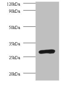 PSMA7 Antibody - Western blot All lanes: PSMA7 antibody at 2µg/ml + 293T whole cell lysate Secondary Goat polyclonal to rabbit IgG at 1/10000 dilution Predicted band size: 28, 21, 17 kDa Observed band size: 28 kDa