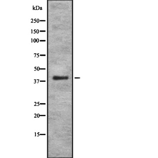 PSMA7 Antibody - Western blot analysis of PSMA7 using HeLa whole cells lysates