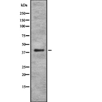 PSMA7 Antibody - Western blot analysis of PSMA7 using HeLa whole cells lysates
