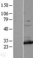 PSMA7 Protein - Western validation with an anti-DDK antibody * L: Control HEK293 lysate R: Over-expression lysate
