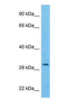 PSMA8 Antibody - Western blot of PSA7L Antibody with human Ovary Tumor lysate.  This image was taken for the unconjugated form of this product. Other forms have not been tested.