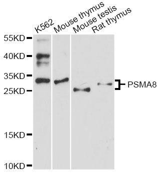 PSMA8 Antibody - Western blot analysis of extracts of various cell lines, using PSMA8 antibody at 1:3000 dilution. The secondary antibody used was an HRP Goat Anti-Rabbit IgG (H+L) at 1:10000 dilution. Lysates were loaded 25ug per lane and 3% nonfat dry milk in TBST was used for blocking. An ECL Kit was used for detection and the exposure time was 90s.