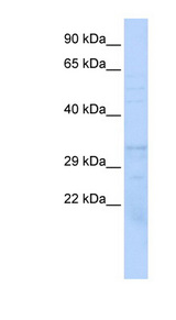 PSMB1 Antibody - PSMB1 antibody Western blot of 721_B cell lysate. This image was taken for the unconjugated form of this product. Other forms have not been tested.