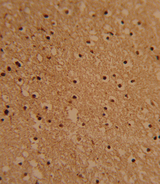 PSMB1 Antibody - Formalin-fixed and paraffin-embedded human brain tissue reacted with PSMB1 Antibody , which was peroxidase-conjugated to the secondary antibody, followed by DAB staining. This data demonstrates the use of this antibody for immunohistochemistry; clinical relevance has not been evaluated.