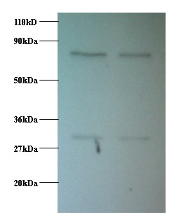 PSMB1 Antibody - Western blot of Proteasome subunit beta 1 antibody at 2 ug/ml. Lane 1: EC109 whole cell lysate. Lane 2: 293T whole cell lysate. Secondary: Goat polyclonal to Rabbit IgG at 1:15000 dilution. Predicted band size: 26.4 kDa. Observed band size: 30 kDa Additional bands at: 75 kDa. We are unsure as to the identity of this extra band.  This image was taken for the unconjugated form of this product. Other forms have not been tested.