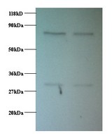 PSMB1 Antibody - Western blot of Proteasome subunit beta 1 antibody at 2 ug/ml. Lane 1: EC109 whole cell lysate. Lane 2: 293T whole cell lysate. Secondary: Goat polyclonal to Rabbit IgG at 1:15000 dilution. Predicted band size: 26.4 kDa. Observed band size: 30 kDa Additional bands at: 75 kDa. We are unsure as to the identity of this extra band.  This image was taken for the unconjugated form of this product. Other forms have not been tested.