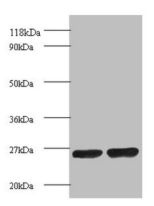 PSMB1 Antibody - Western blot All lanes: Proteasome subunit beta 1 antibody at 2µg/ml Lane 1: EC109 whole cell lysate Lane 2: 293T whole cell lysate Secondary Goat polyclonal to rabbit IgG at 1/15000 dilution Predicted band size: 27 kDa Observed band size: 27 kDa
