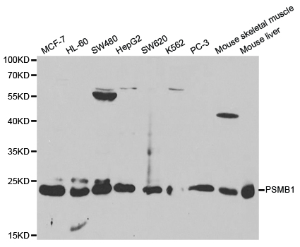 PSMB1 Antibody - Western blot analysis of extracts of various cell lines, using PSMB1 antibody at 1:1000 dilution. The secondary antibody used was an HRP Goat Anti-Rabbit IgG (H+L) at 1:10000 dilution. Lysates were loaded 25ug per lane and 3% nonfat dry milk in TBST was used for blocking.