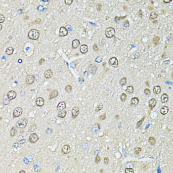 PSMB1 Antibody - Immunohistochemistry of paraffin-embedded rat brain using PSMB1 antibodyat dilution of 1:100 (40x lens).