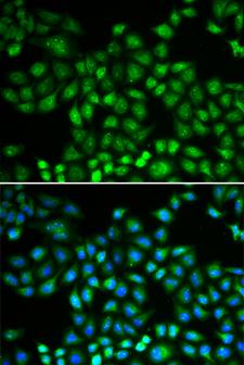PSMB1 Antibody - Immunofluorescence analysis of MCF-7 cells using PSMB1 antibody. Blue: DAPI for nuclear staining.
