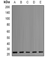PSMB1 Antibody - Western blot analysis of PSMB1 expression in MCF7 (A); HepG2 (B); K562 (C); PC3 (D); mouse liver (E) whole cell lysates.