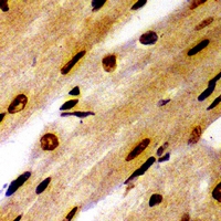 PSMB1 Antibody - Immunohistochemical analysis of PSMB1 staining in mouse heart formalin fixed paraffin embedded tissue section. The section was pre-treated using heat mediated antigen retrieval with sodium citrate buffer (pH 6.0). The section was then incubated with the antibody at room temperature and detected using an HRP conjugated compact polymer system. DAB was used as the chromogen. The section was then counterstained with hematoxylin and mounted with DPX.