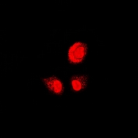 PSMB1 Antibody - Immunofluorescent analysis of PSMB1 staining in U2OS cells. Formalin-fixed cells were permeabilized with 0.1% Triton X-100 in TBS for 5-10 minutes and blocked with 3% BSA-PBS for 30 minutes at room temperature. Cells were probed with the primary antibody in 3% BSA-PBS and incubated overnight at 4 deg C in a humidified chamber. Cells were washed with PBST and incubated with a DyLight 594-conjugated secondary antibody (red) in PBS at room temperature in the dark.