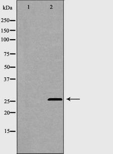 PSMB1 Antibody - Western blot analysis of A431 lysate using PRKCD antibody. The lane on the left is treated with the antigen-specific peptide.
