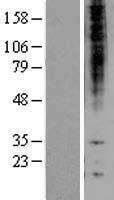 PSMB1 Protein - Western validation with an anti-DDK antibody * L: Control HEK293 lysate R: Over-expression lysate