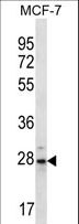PSMB10 Antibody - PSMB10 Antibody western blot of MCF-7 cell line lysates (35 ug/lane). The PSMB10 antibody detected the PSMB10 protein (arrow).