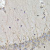 PSMB10 Antibody - Immunohistochemistry of paraffin-embedded rat brain tissue.