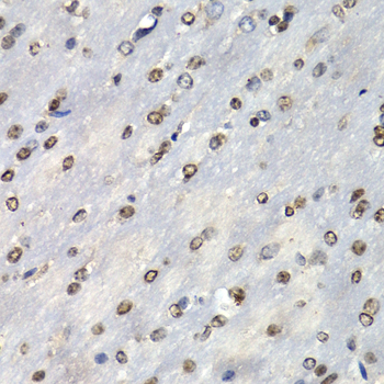 PSMB10 Antibody - Immunohistochemistry of paraffin-embedded mouse brain tissue.