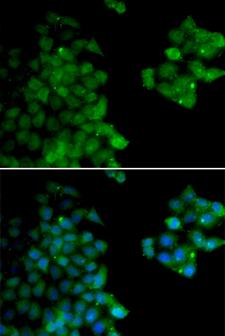 PSMB10 Antibody - Immunofluorescence analysis of HeLa cells.