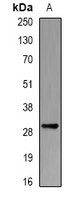 PSMB10 Antibody - Western blot analysis of PSMB10 expression in THP1 (A) whole cell lysates.