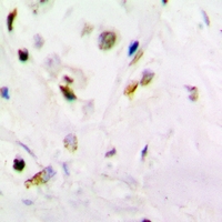 PSMB10 Antibody - Immunohistochemical analysis of PSMB10 staining in mouse brain formalin fixed paraffin embedded tissue section. The section was pre-treated using heat mediated antigen retrieval with sodium citrate buffer (pH 6.0). The section was then incubated with the antibody at room temperature and detected using an HRP conjugated compact polymer system. DAB was used as the chromogen. The section was then counterstained with hematoxylin and mounted with DPX.