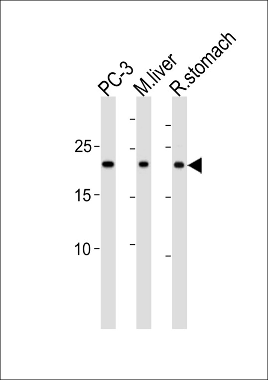 PSMB2 Antibody - PSMB2 Antibody western blot of PC-3 cell line, mouse liver and rat stomach tissue lysates (35 ug/lane). The PSMB2 antibody detected the PSMB2 protein (arrow).