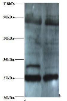PSMB2 Antibody - Western blot of proteasome subunit beta type-2 antibody at 2 ug/ml. Lane 1: EC109whole cell lysate. Lane 2: 293T whole cell lysate. Secondary: Goat polyclonal to Rabbit IgG at 1:15000 dilution. Predicted band size: 22.9 kDa. Observed band size: 27 kDa Additional bands at: 75 kDa. We are unsure as to the identity of these extra band.  This image was taken for the unconjugated form of this product. Other forms have not been tested.