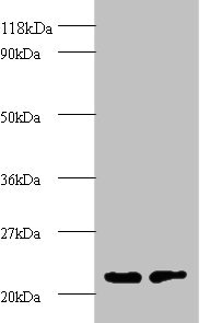 PSMB2 Antibody - Western blot All lanes: proteasome subunit beta type-2 antibody at 2µg/ml Lane 1: EC109 whole cell lysate Lane 2: 293T whole cell lysate Secondary Goat polyclonal to rabbit IgG at 1/15000 dilution Predicted band size: 23 kDa Observed band size: 23 kDa